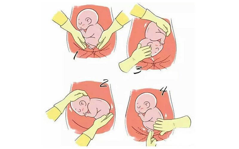 胎位纠正图 姿势图片