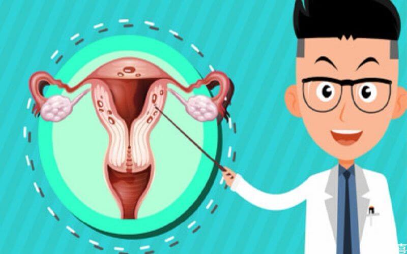 判断女性出现子宫内膜异位的方法