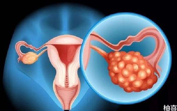 囊胚移植失败后怎样快速恢复卵巢？