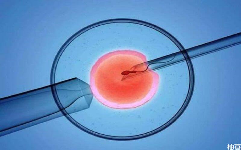 用精子库中的精子做人工受孕
