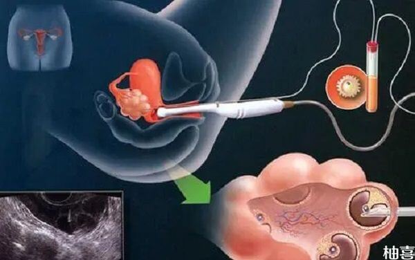 试管取卵后可以坐摩托车吗？