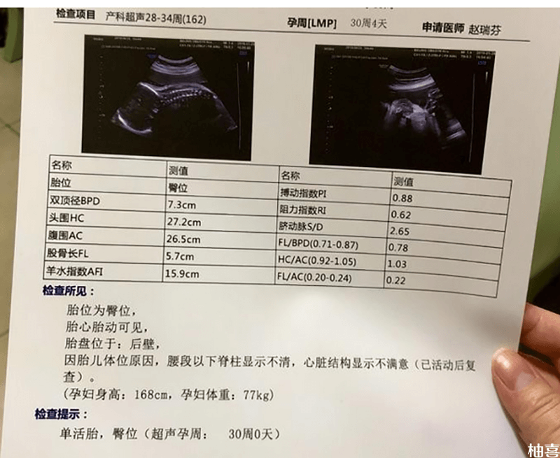 小排畸的检查项目