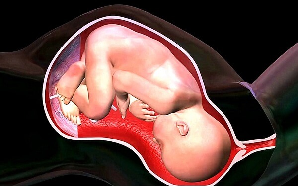 怀孕12周nt检查发现胎儿一直是趴着怎么尽快转身？