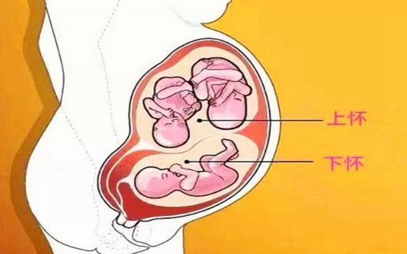 孕妇前壁下怀肚子显大和胎儿性别是没有任何关系的