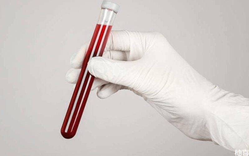 血常规检查是最普通血液检查