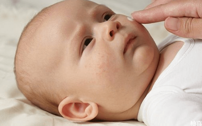 宝宝体质脆弱容易患皮肤病
