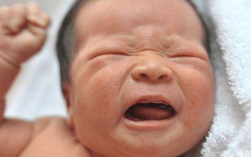 婴儿面部发热为胎毒