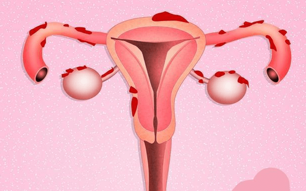 子宫脱垂离不开这4大原因，产后一个小动作就能预防！