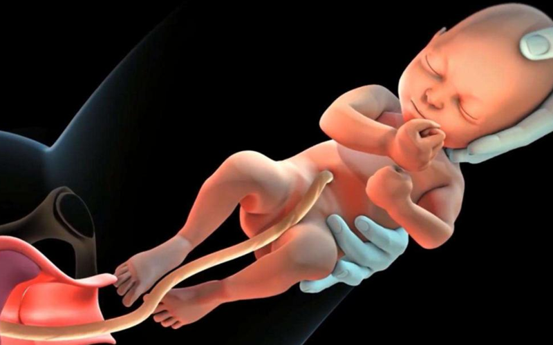 臀位不能确定胎儿的性别