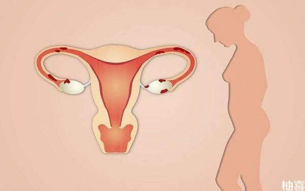 患者做输卵管造影可以疏通输卵堵塞的现象吗？