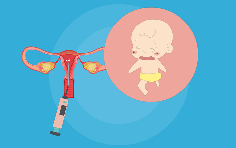 精子活动力c级人工授精可以怀孕 