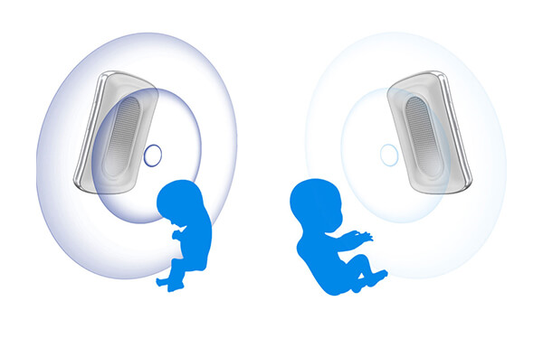 家用胎教仪使用不当会导致胎儿耳聋是真的吗？