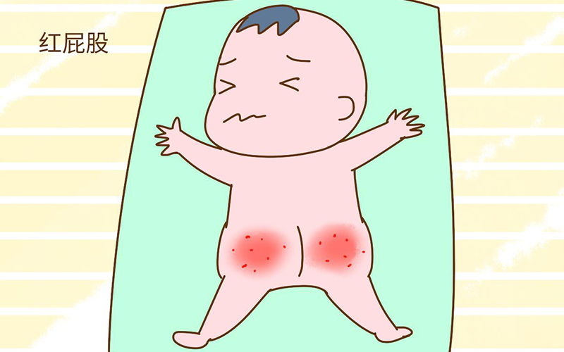 宝宝存在屁股红的现象时有必要买护臀膏