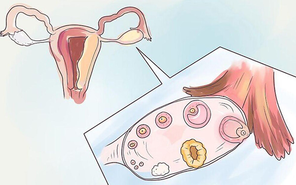 备孕测基础卵泡的最佳时间是月经来后的第几天?
