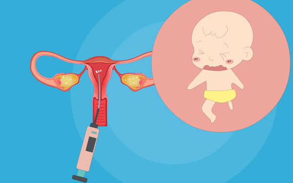 女性进行人工受孕时能按照父母的意愿选择双胎受孕吗？