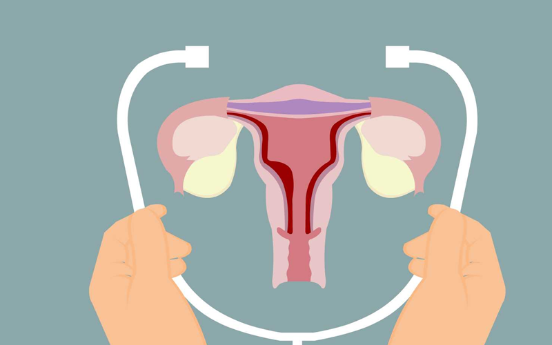 子宫纵膈要及时治疗