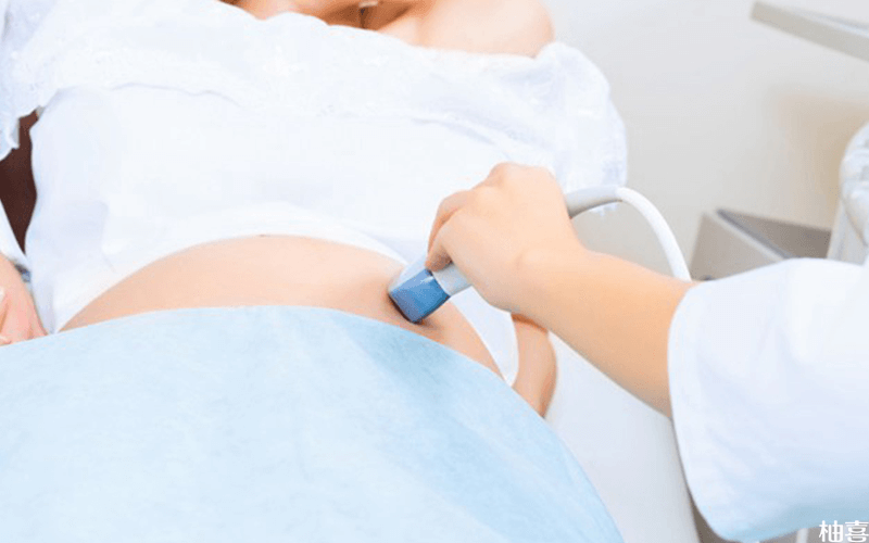 女性怀孕b超检查