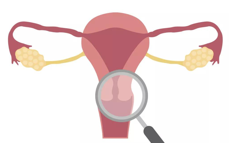 子宫内膜病变需要做检查才能判断