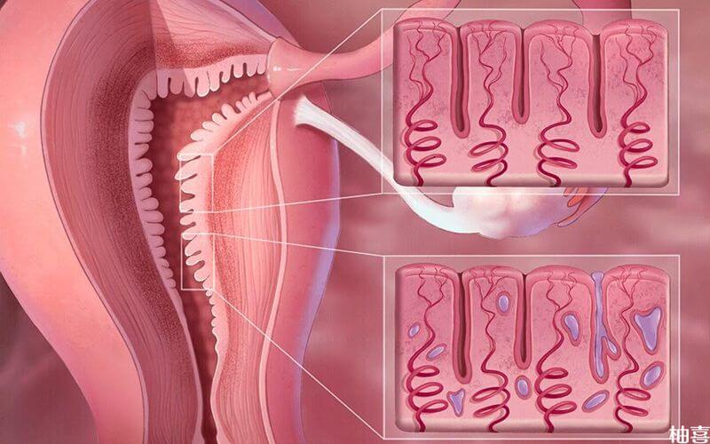子宫内膜薄影响胚胎着床