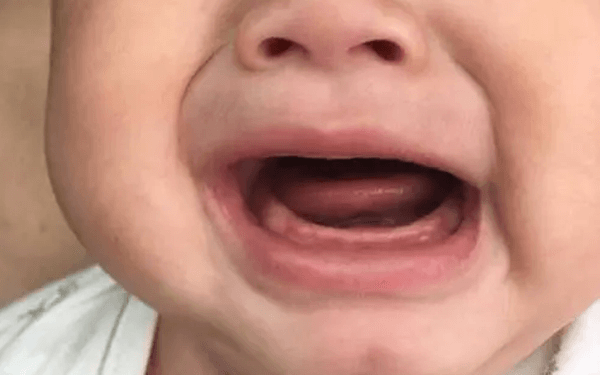 网友分享孩子特效照片：原来可爱是因为没牙齿
