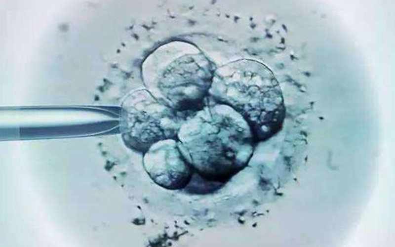 鲜胚移植