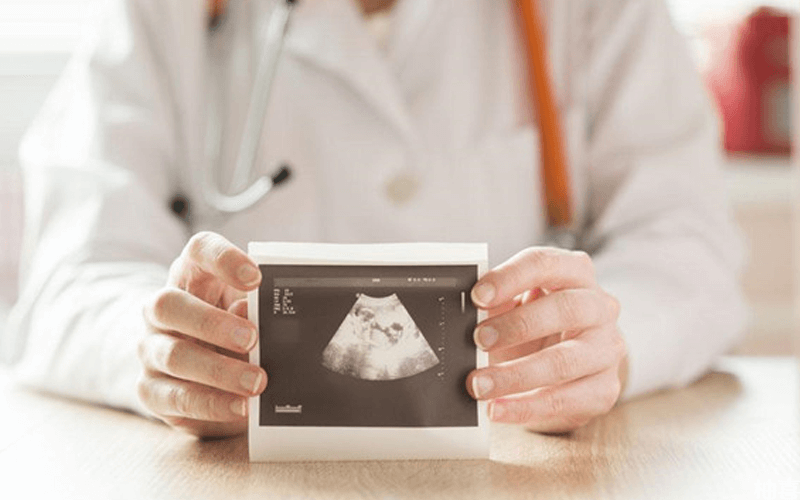 胎儿染色体检查