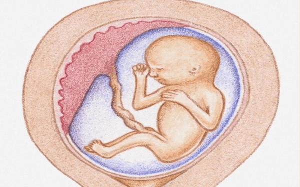 34周胎儿2条脐动脉暗示生男还是生女？