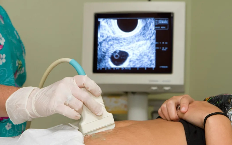 冻胚移植后正在检查的女性