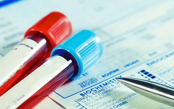 孕妇ca125的指标高达56是否正常?