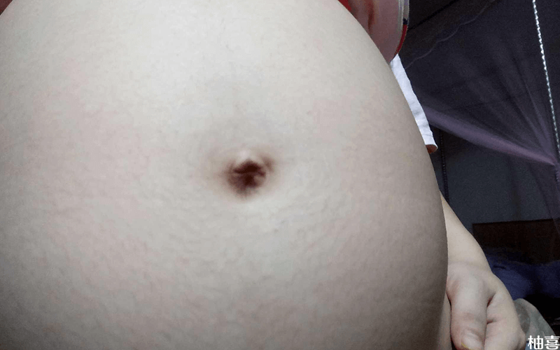 孕妇肚形
