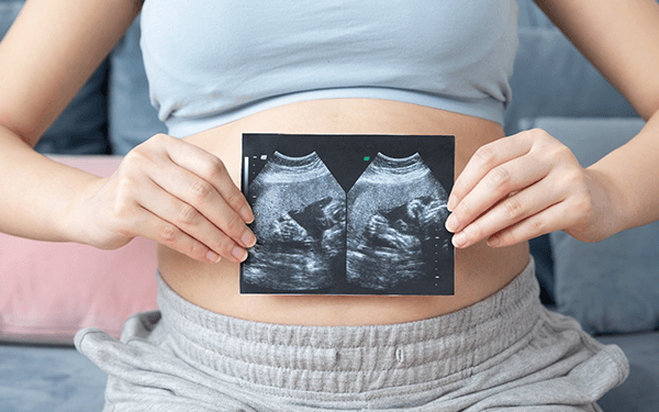 优生四项检查是怀孕几周可以做?