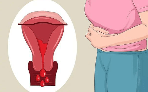 闭经女性吃什么中药改善卵巢最管用?