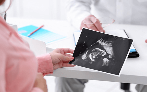 大夫说有卵黄囊就说明胎儿发育很好是真的吗?