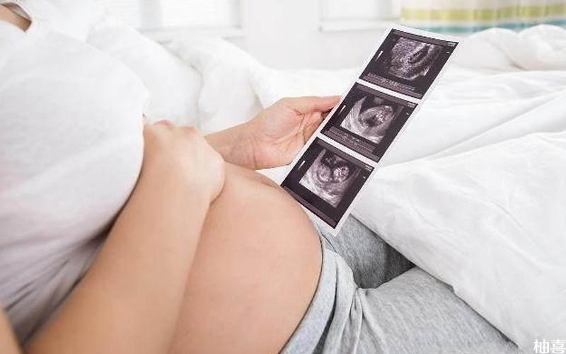 孕妇要按时做产检观察胎儿发育情况