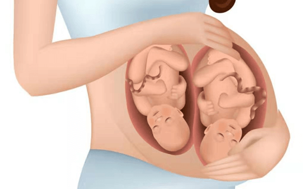 什么体质的女性最容易怀上双胞胎？