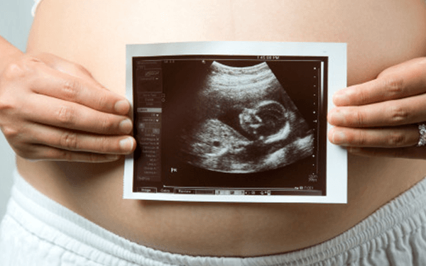 股骨短的胎儿在孕几周可以确诊是否为畸形?