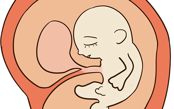 胎盘位置在子宫前壁和后壁哪个顺产更疼?