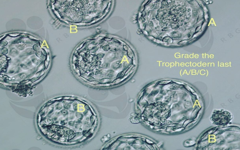 3bc囊胚属于中等级别