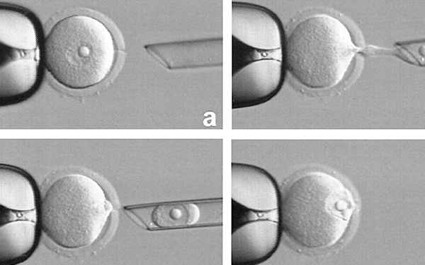 试管婴儿移植用4AA好还是5AA的胚胎好?