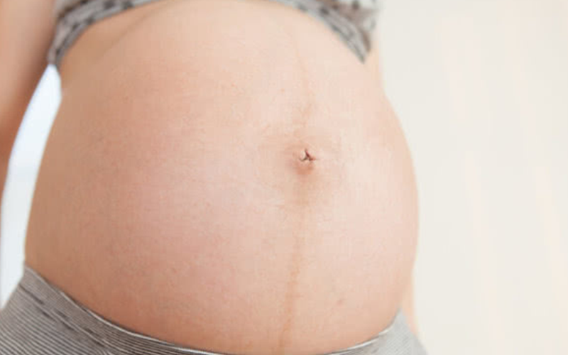 孕妇肚脐样式受很多因素影响