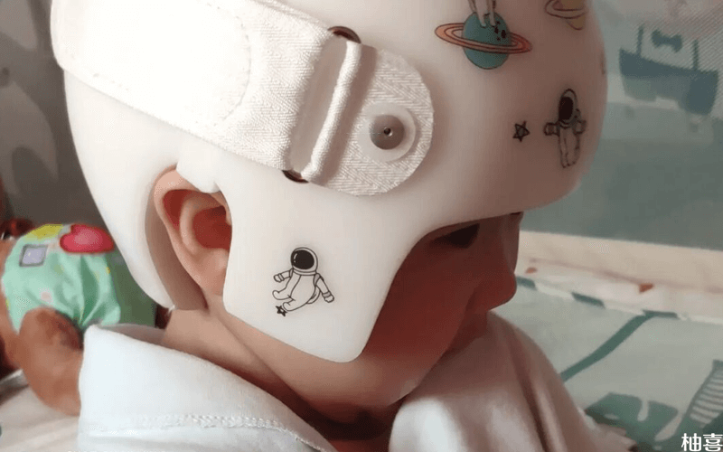 儿童佩戴矫正头盔