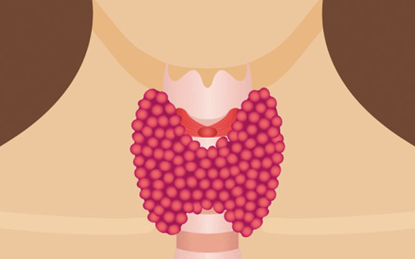 怎么判断4岁的小孩有没有患上甲减?