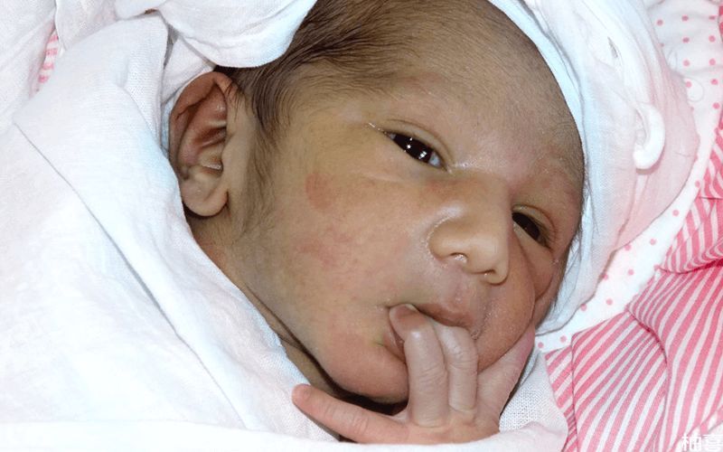 新生儿42项遗传代谢性疾病