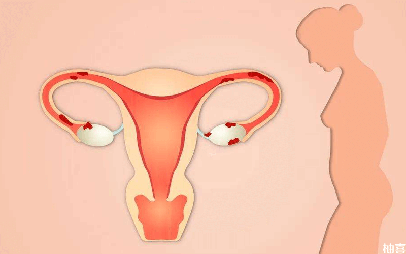 恢复卵巢功能的中成药有很多