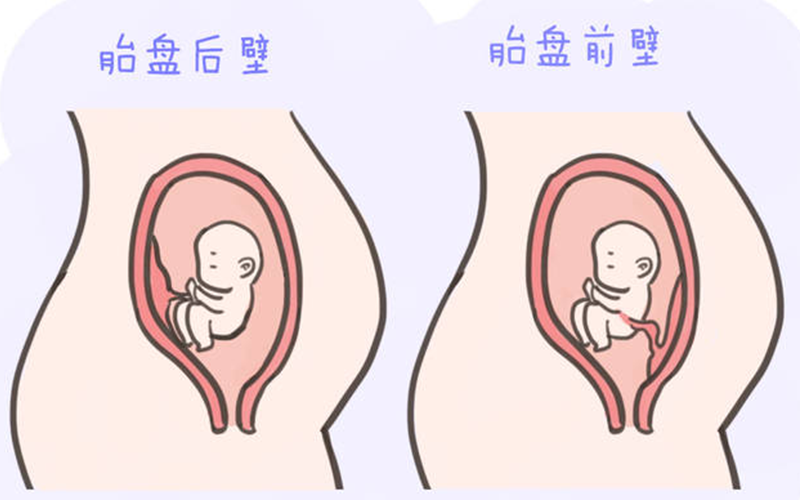 胎儿在子宫后壁比较容易受伤