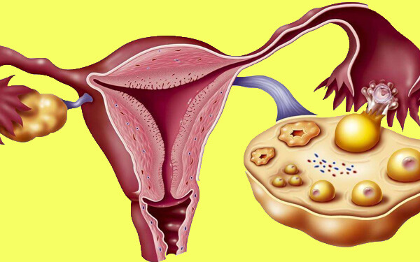 诊断出输卵管性不孕别担心，3种治疗攻略供你选择