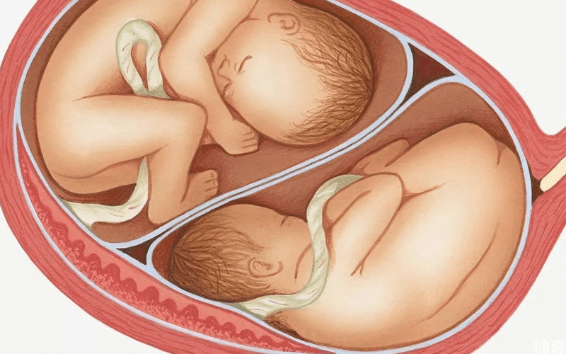 异卵多胞胎示意图