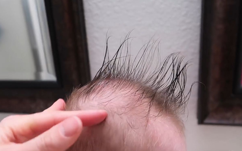 宝宝经常剃光头并不可以增加发量