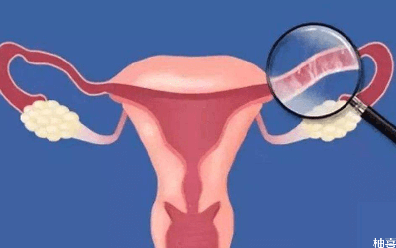 女性输卵管示意图