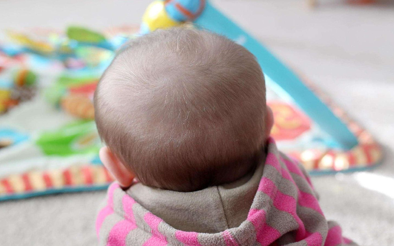 1岁女宝宝头发稀少,剃几次光头能让发质变好?